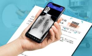 云胶片取代传统的医用胶片是必然趋势！	